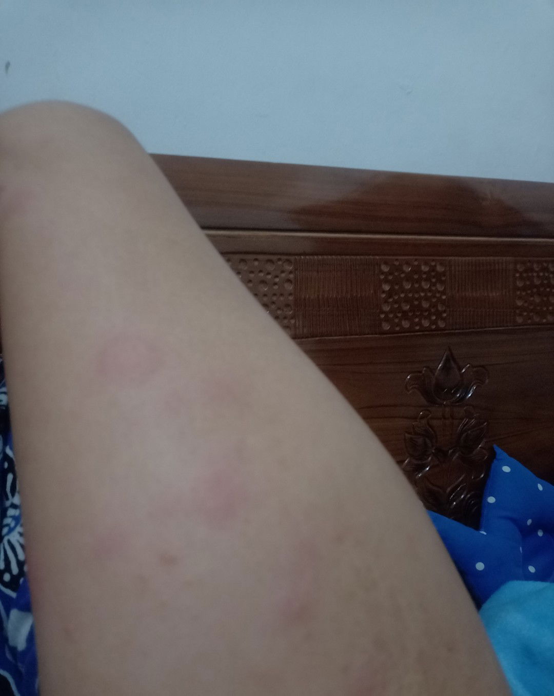 gatal gatal setelah melahirkan