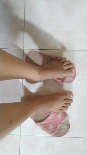 postpartum issues
