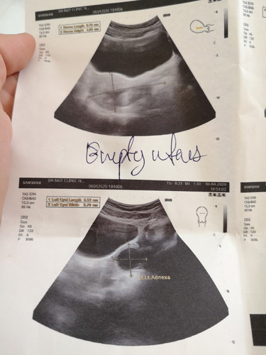 ประจำเดือนมาครั้งล่าสุด วันที่14 กุมภาพันธ์ ตรวจไม่ท้อง