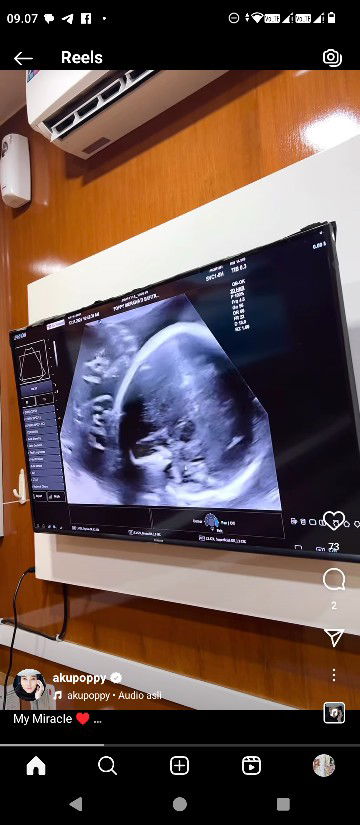 bunga abadi profile icon