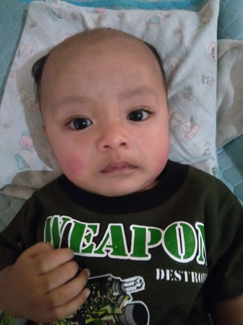 badan bayi merah2