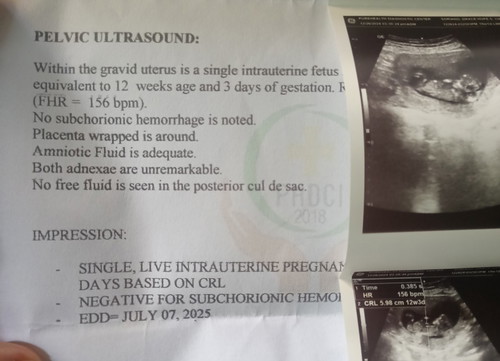 Wrapped around Placenta