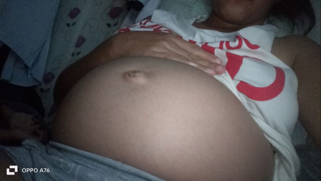 Eprel Rose Balabag profile icon