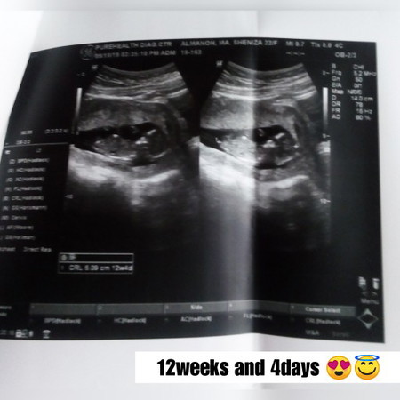 3months preggy