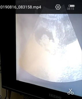 hamil sang buah hati