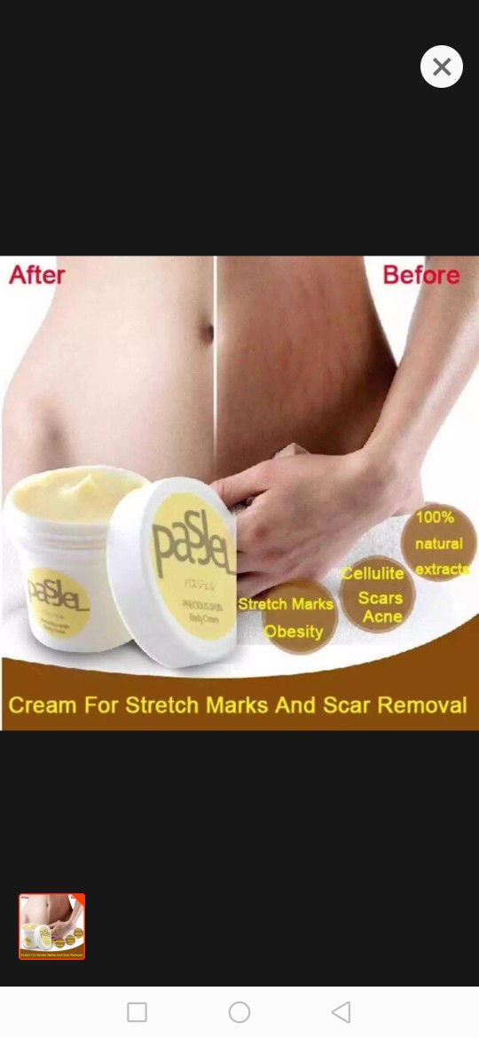 Stretchmark Remover