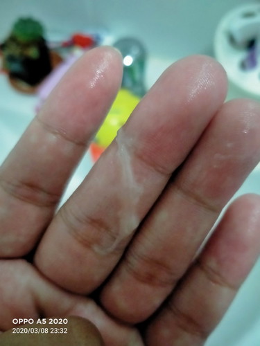 สอบถาม