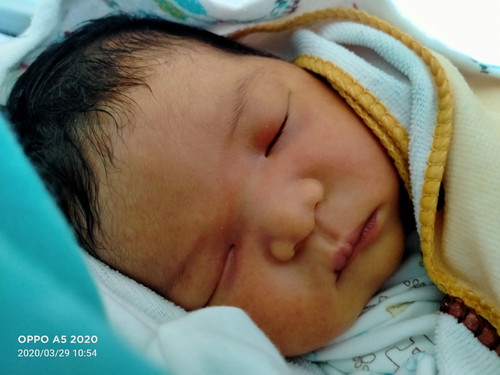 คลอดตอน 39+2