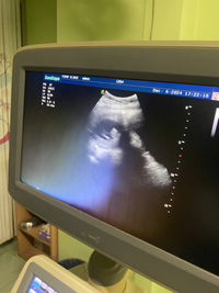 สุพาดา อุลมาน profile icon