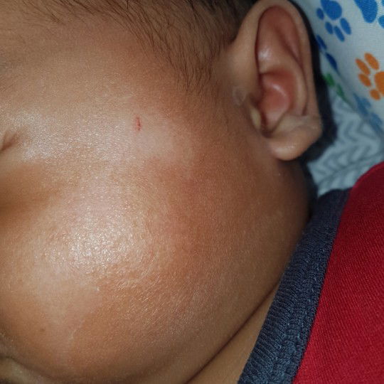 Pipi bayi kering dan muncul bercak putih