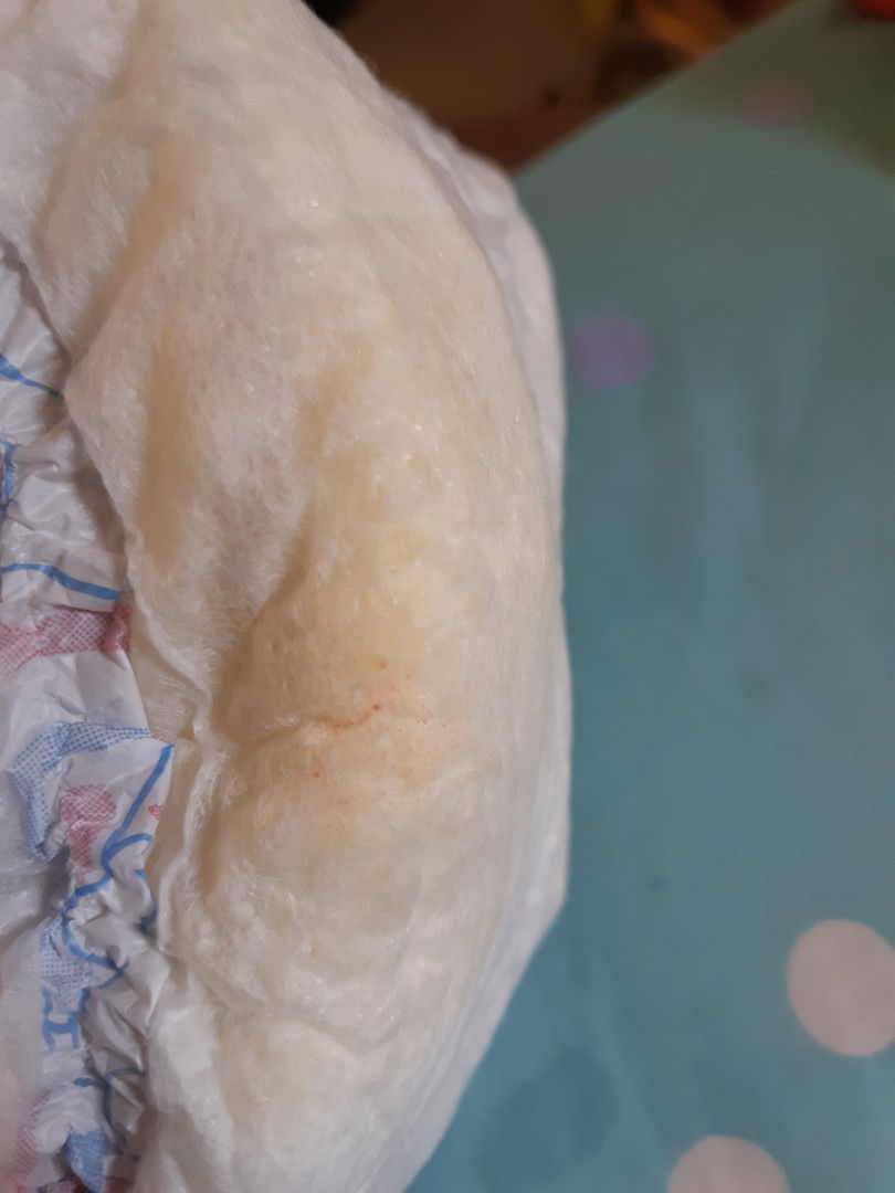 bercak di popok