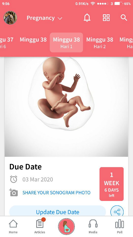 semoga ada yg mau bantu jawab pertanyaan saya ini.