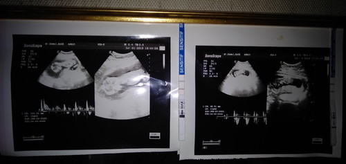 tolong dijawab bunda :(