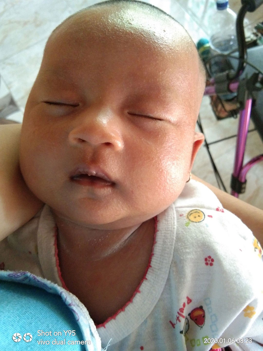 Bruntusan merah d wajah