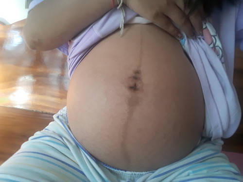 แม่ๆรู้เพศกันตอนกี่วีคคะ