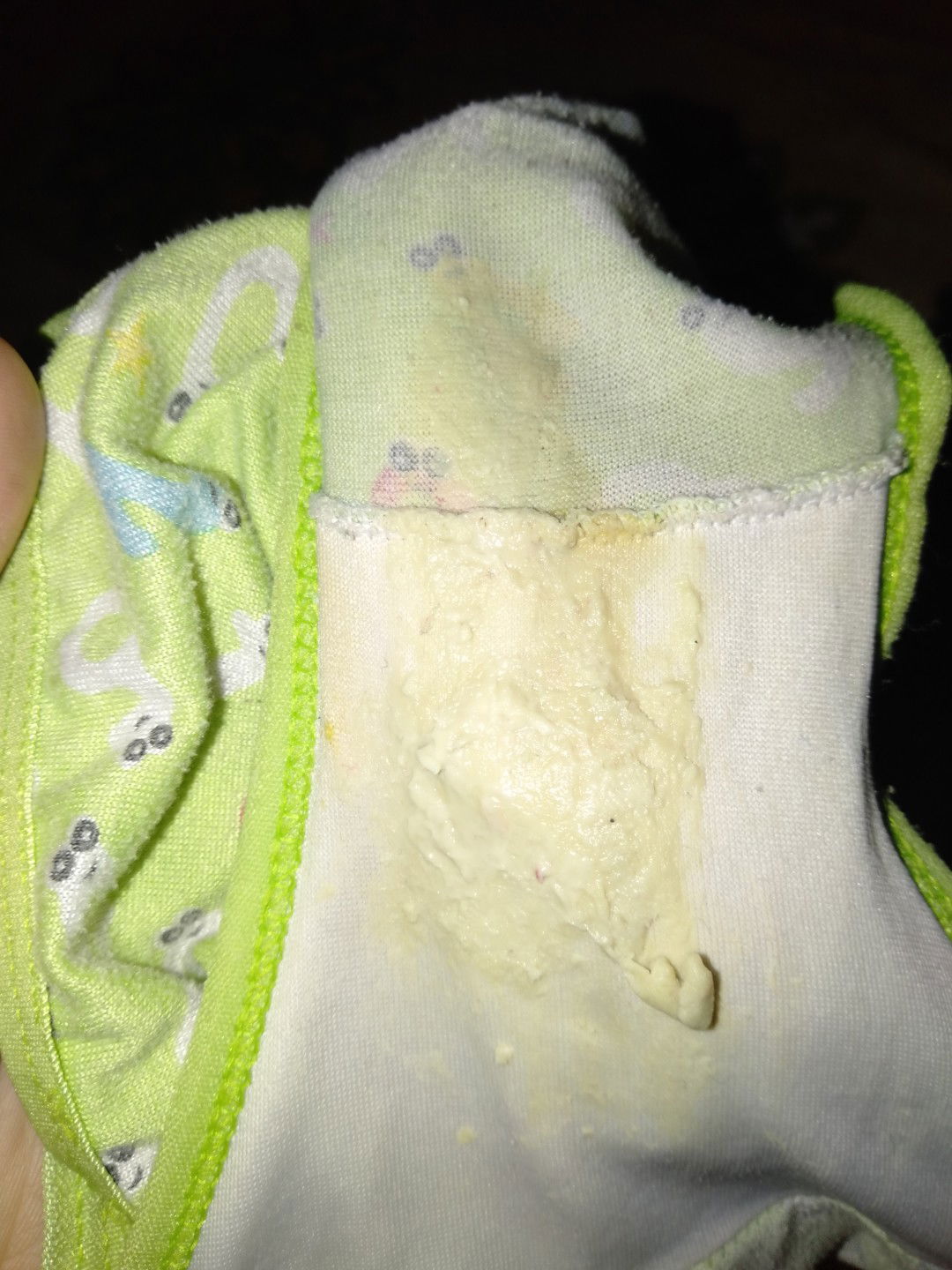 Jangan dibuka kalau tidak mau melihat.,  maaf jijik cuma cari solusi????