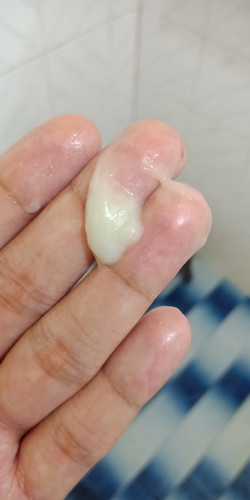 ตกขาว