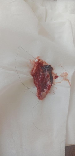 อันนี้คือแท้งไหมคะ😓