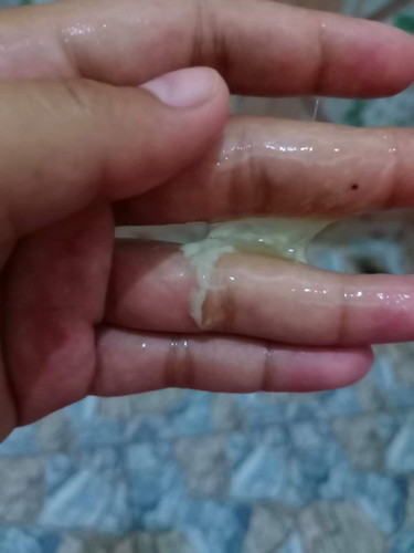 39w มีมูกใส