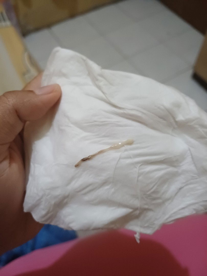 halo bun
ini kehamilan pertama saya (6week) saya kawatir ada muncul spt ini