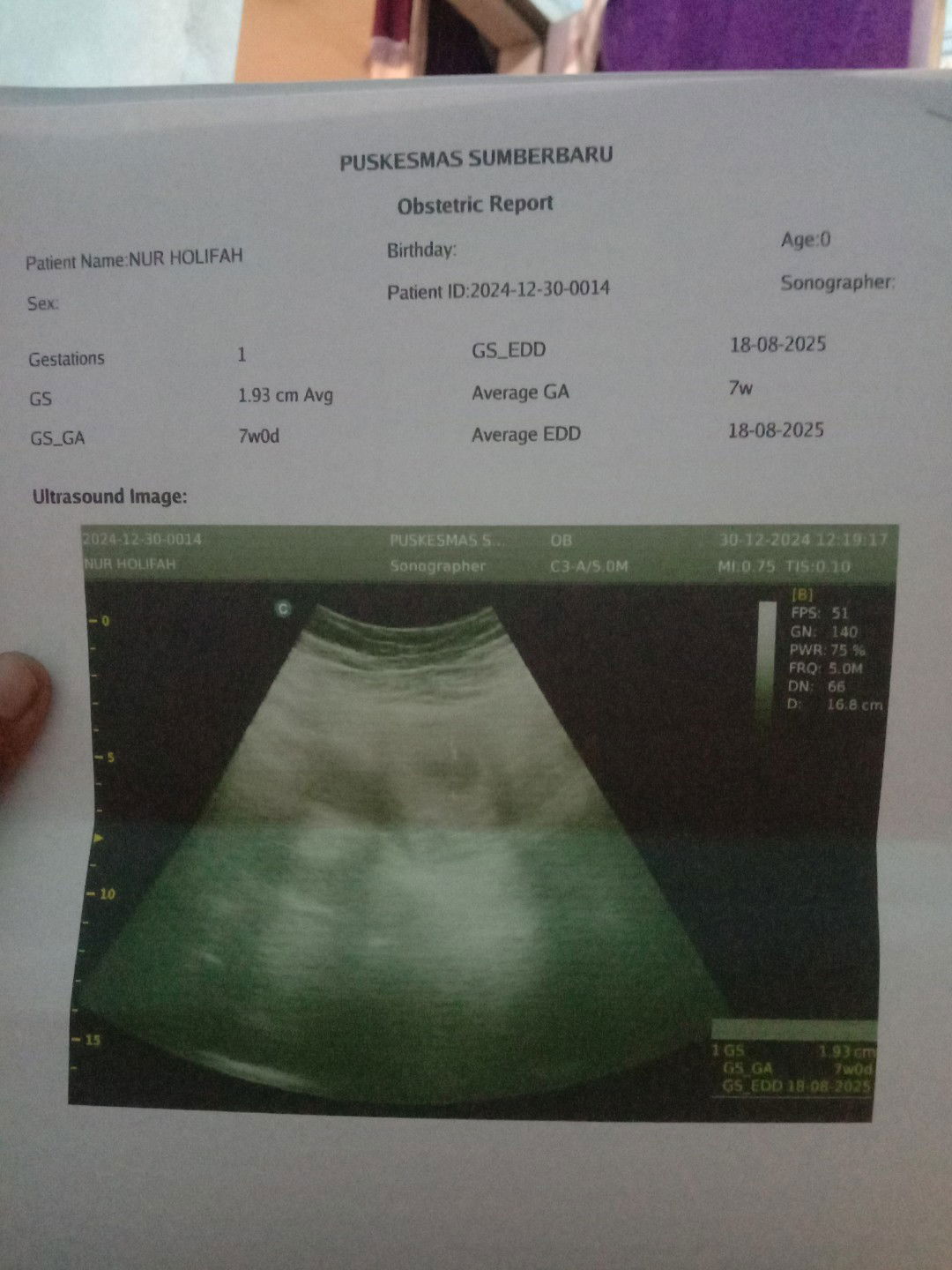 Usg 7 minggu hanya kelihatan kantong nya saja