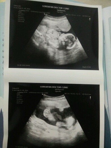 17+6weeks