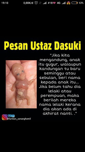Sharing yg Sudah mengalami keguguran tetapi anak nya emang harus di kasih nama/tidal walaupun ke guguran seperti gamar di bawah