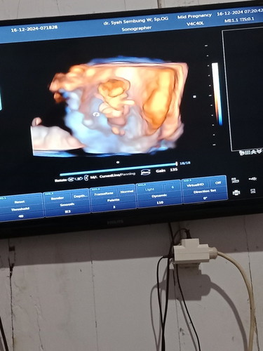 Kok belum muncul ya apa pas lagi 3 bulan umur kadungannya ya xo belum muncul