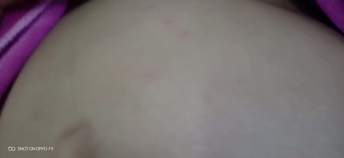 ผิ่นขึ้นท้องคะ