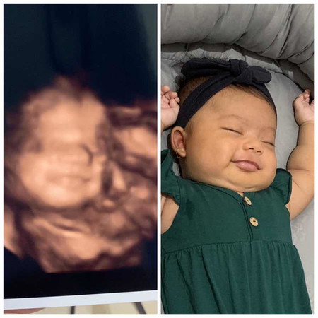 Foto usg dan foto bayi ?