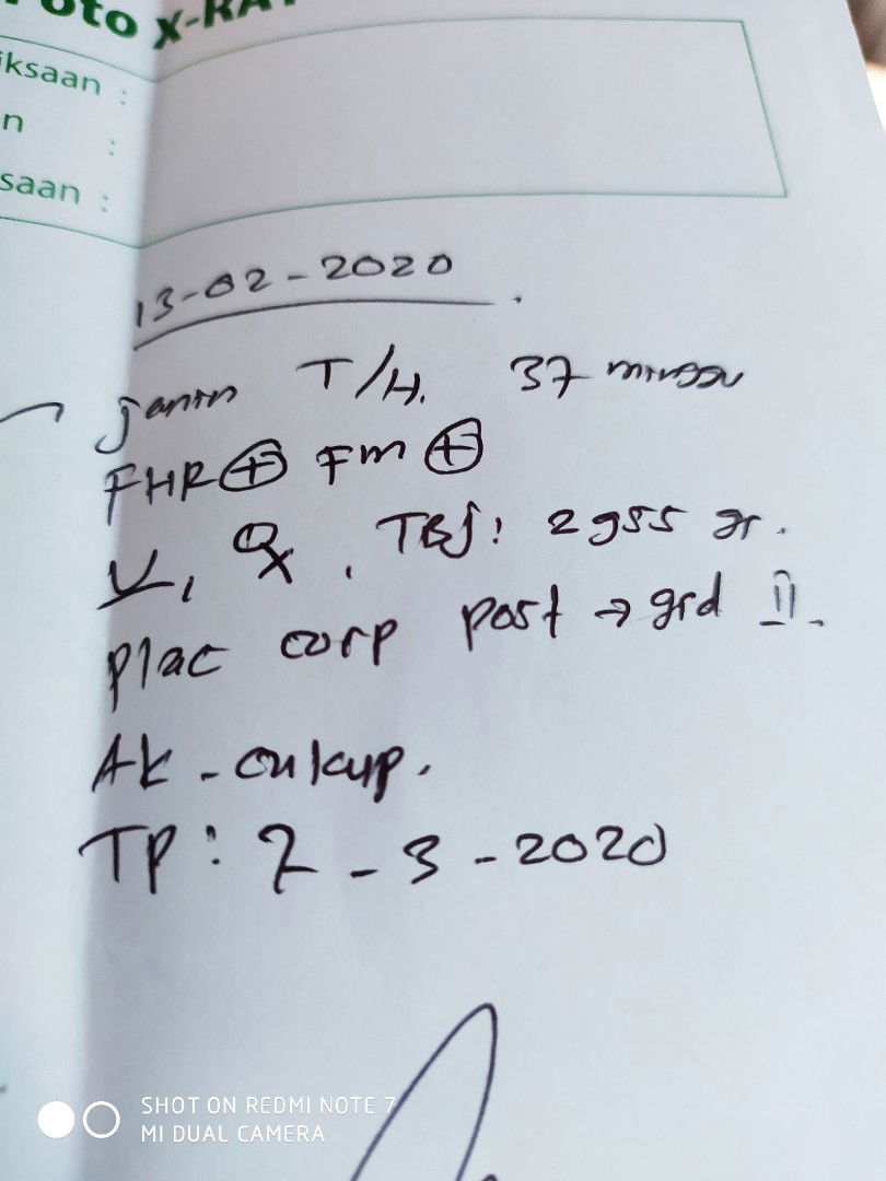 banyak yg bilang perut nya kecil