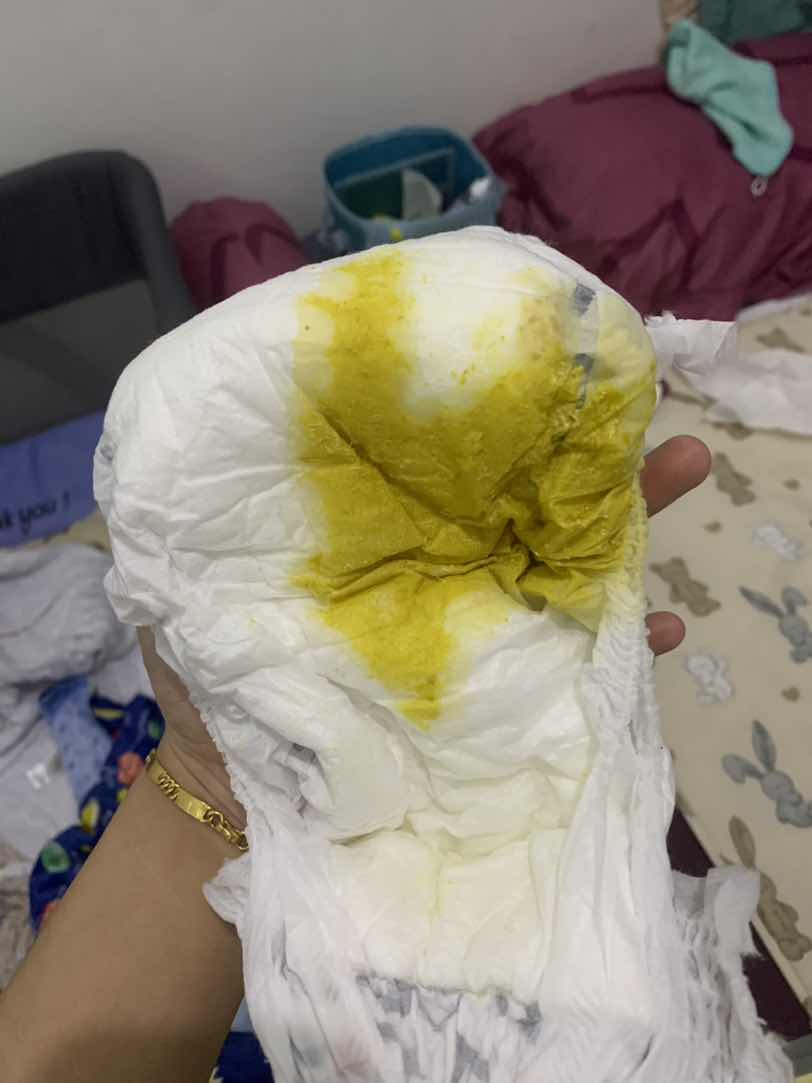 Maaf kalo jorok, tapi urgent krna aku newmom