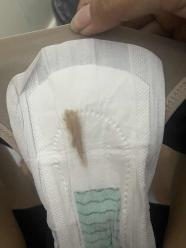 Brown Discharge