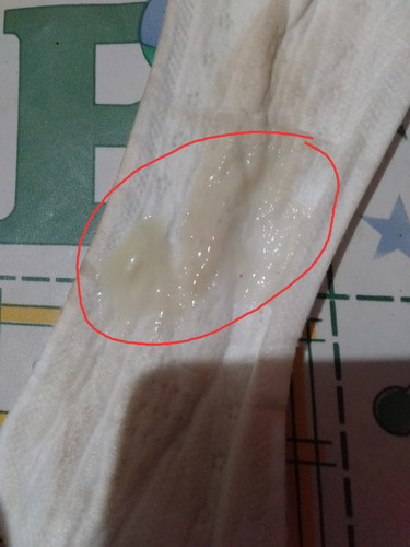 Yellowgreen discharged