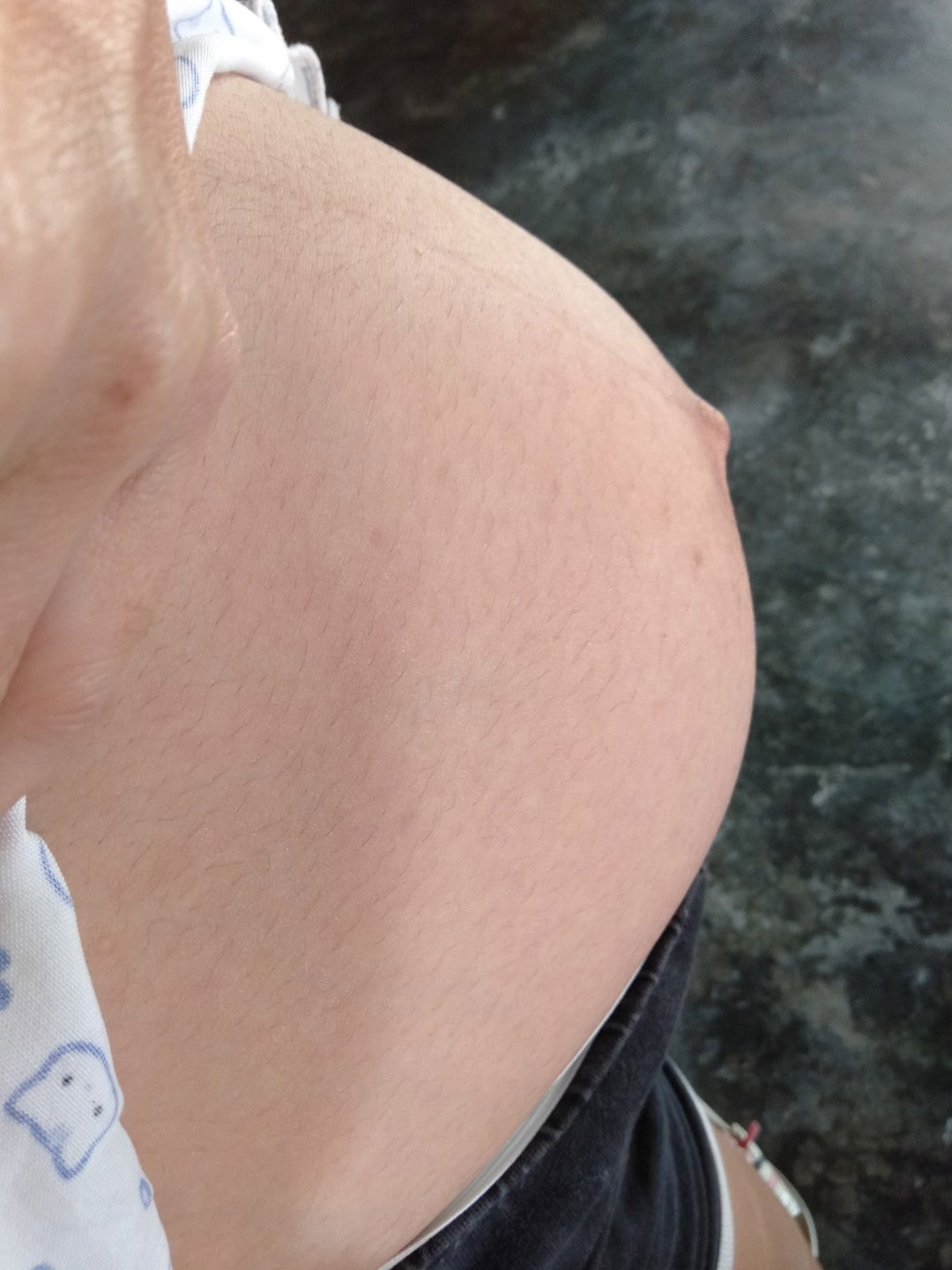 ท้องไม่ยุบหลังคลอดเหมือนคนอื่นๆเกิดจากอะไร