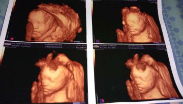 AiNi AiNi profile icon