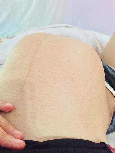 คืออะไร