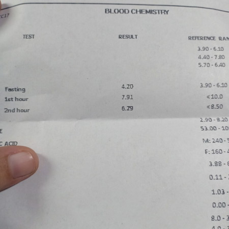 Mataas po o normal po? :)