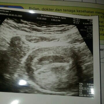kehamilan