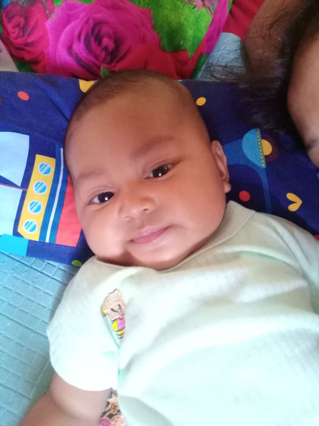 belum bisa angkat leher