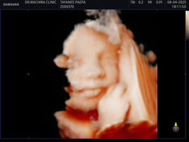 Thayanee Patta profile icon