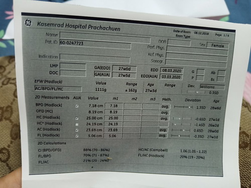 น้ำหนักทารก