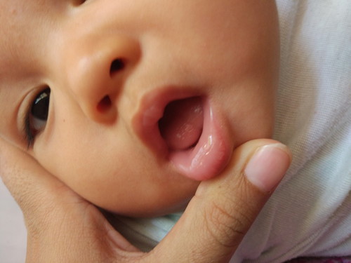 Bersihkan Mulut Bayi