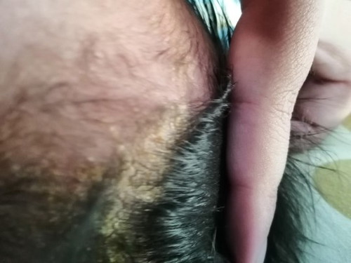 หนังหัว