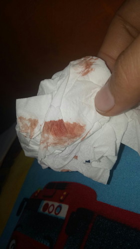 hamil 9 minggu