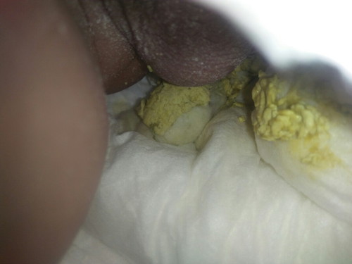 ลูก3เดือน 20 วัน