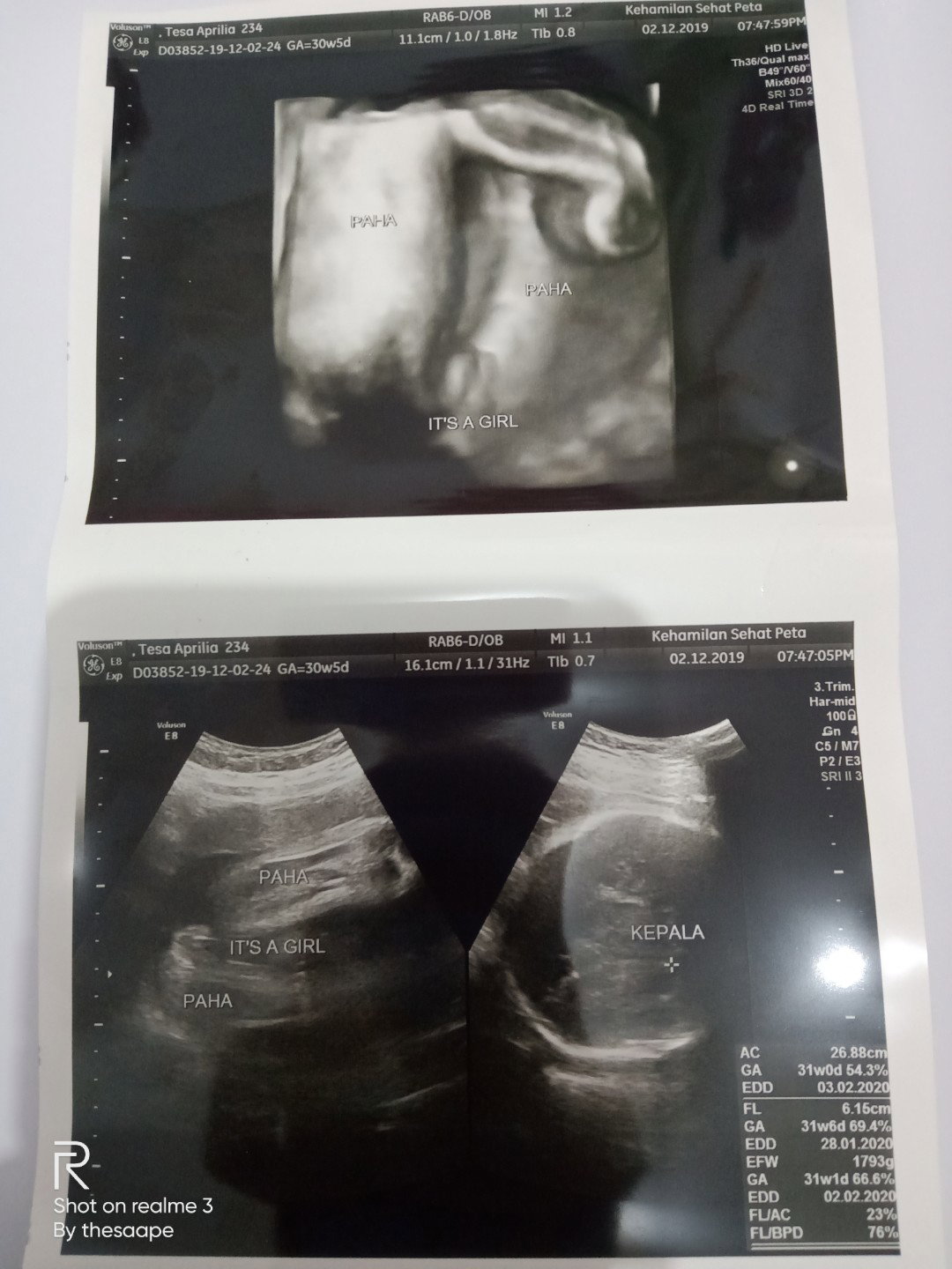 bayi tengkurep