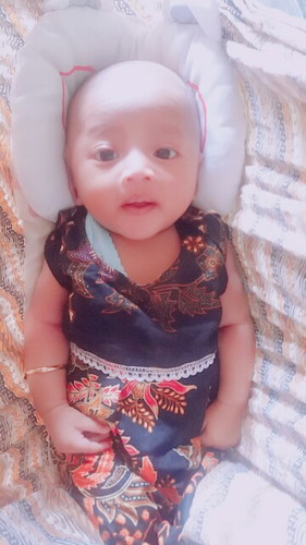 rambut bayi gak tumbuh2...