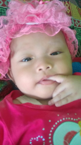 alis tipis