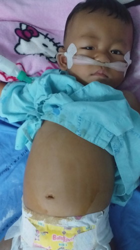 ไข้เลือดออก